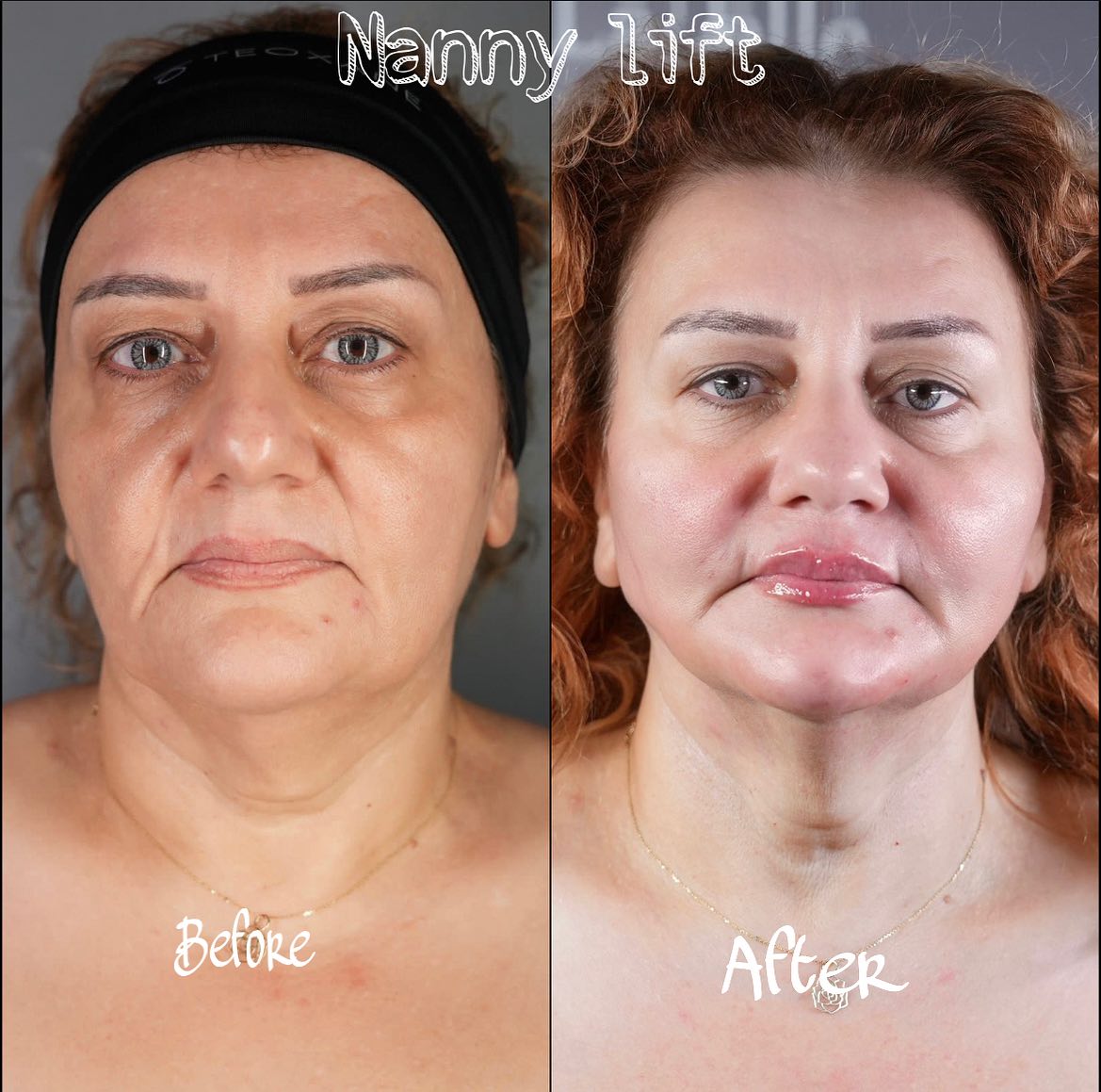 377881346_18310026769111450_4800452580752216623_n