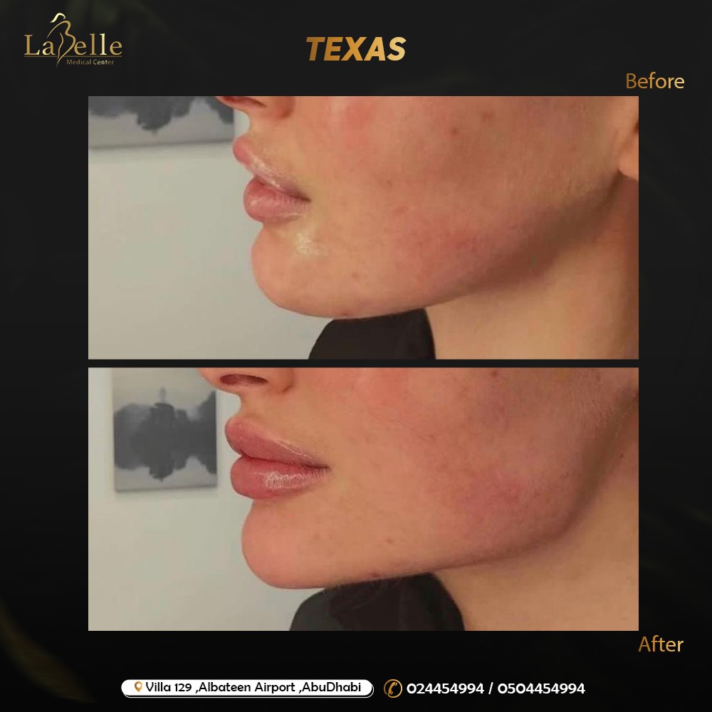 395374815_122114287466052446_4894030531582697395_n