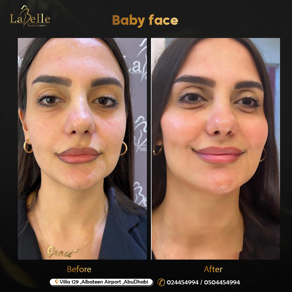 396737439_122115031820052446_8679553070432809863_n